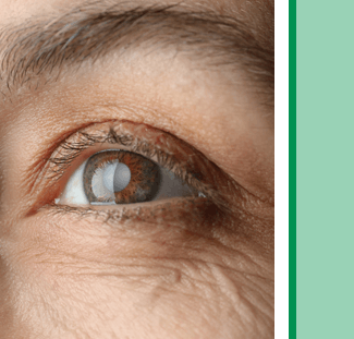 Cataracts symptoms, diagnosis and treatment