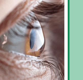 keratoconus symptoms, diagnosis and treatment