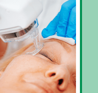 laser skin resurfacing treatment